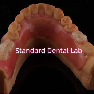 Dentitas Parsial Valplast Fleksibel dan Sangat Estetis Mudah Dibersihkan