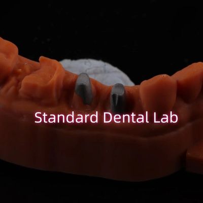 Metal Post Core Crown CAD CAM Porselen / Zirconia Coping Full Zircnonia Bruxier Crown