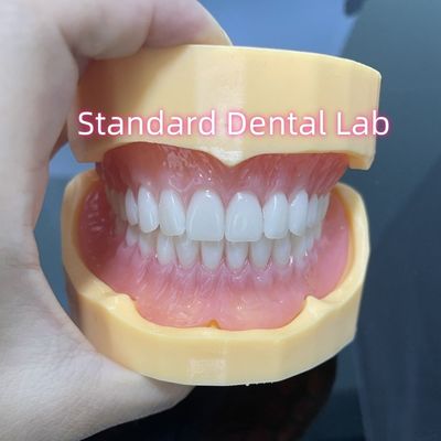 Gigi Akrilik Bagian Atas dan Bawah Yang Sangat Estetis Gigi Ivoclar Permen karet