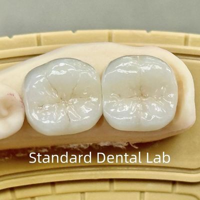 Mahkota Lab Gigi Translucent Full Contour Zirconia Dengan Kekuatan Superior