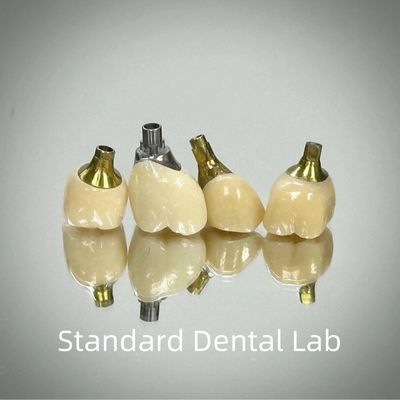 Profesional Zirconia Screw Retained Implant Crown Titanium CAD CAM