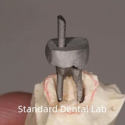 Restorasi Gigi Metal Post Dan Core Crown Cocok Sempurna
