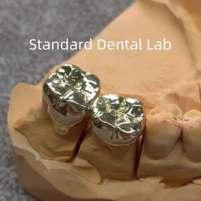 High Nobel Yellow Dental Gold Crowns Profesional Ni Be Free Disetujui ISO