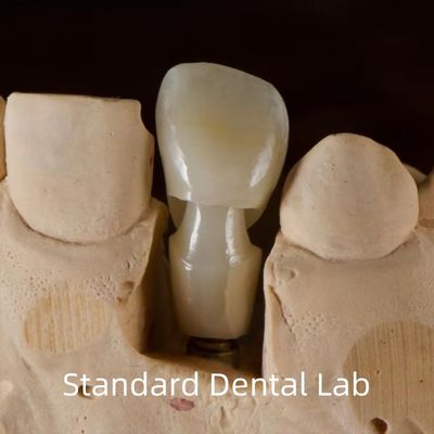 Implan Gigi Tibase Zirconia Abutment Titanium Keakuratan Disesuaikan