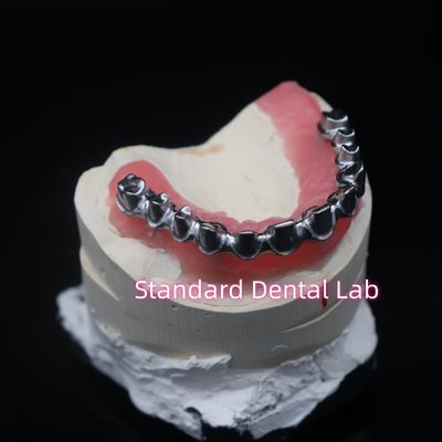 Full Arch Malo Bridge Restorasi Gigi Zirconia Mahkota Dengan Gum Poecelian China Dental Lab