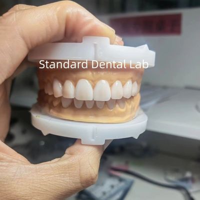 Perfect Esthetics Wax Up Sementara untuk Profesional Gigi menggunakan lilin gigi dari China Dental Lab