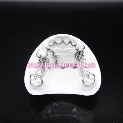 Cetak Scheftner Metal Parsial Denture Frame Tepat Disesuaikan Cast Parsial Denture