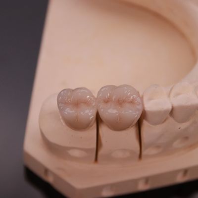 Mahkota Zirconia yang nyaman dengan finishing estetika yang tepat Ekspres 3-4 hari Waktu pengiriman
