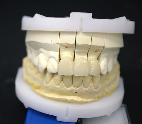 Precision Zirconia Crown Bridge Comfortable Fit / Estetika 3-4 hari Waktu pengiriman cepat