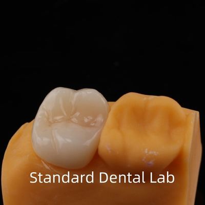 Jaminan 5 tahun full contour Zirconia Crown untuk gigi molar Noritake Porselen Dibuat oleh Laboratorium Gigi Terpercaya