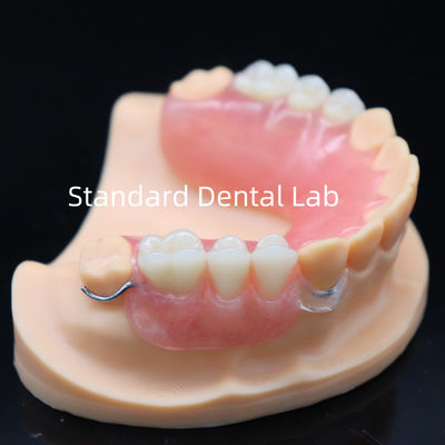 Estetika tinggi akrilik gigi palsu parsial dengan gesper yang jernih dan gigi akrilik China Dental Lab