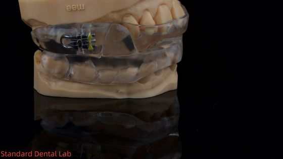 Perangkat Tidur Dorsal Disesuaikan Perangkat Anti Mendengkur Untuk Tidur Nyaman China Dental Lab