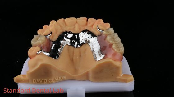 CorCr Metal Parsial Denture Beryllium Bebas Ivoclar Scheftner Kerangka Metal Nyaman