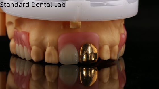 Gigi Akrilik Lengkap Dengan Gigi Emas Kuning / Gigi Sementara Gigi Akrilik Ivoclar Profesional FDA Disetujui