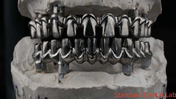 Dental Hybird Malo Implant Bridge Profesional Perfect Fit FDA Certified