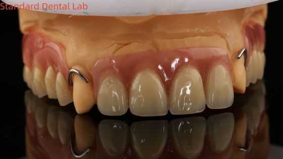 Lab Gigi Akrilik Parsial Ivoclar yang Diobati Dengan Panas Keakuratan tinggi dengan model cetak 3D