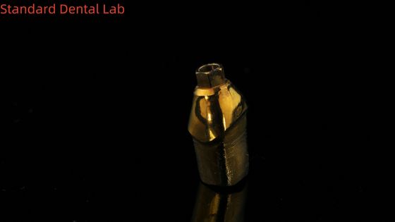 Abutments Custom Titanium Murni Solusi yang Sempurna untuk Restorasi Gigi