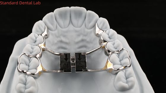 Arch Teeth Palate Expander Stable Hyrax Palatal Expander Perfect Fit SDL Peralatan Ortodontik Lab Gigi