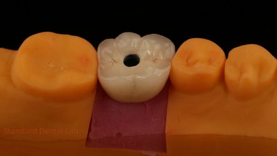 Tulang Penggaruk Dental Sertifikat ISO FDA CE dengan Garansi 5 Tahun