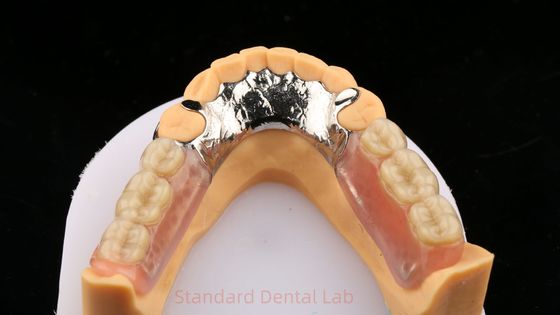 Logam paduan kobalt kromium sebagian gigi palsu Ivoclar Scheftner nyaman Cast Metal Framewrok