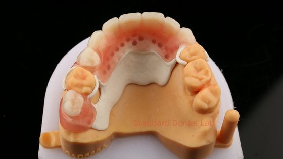 Peek Rangka Parsial Desain ISO CE Dan FDA Dental Lab Akrilik Rangka Parsial Gigi