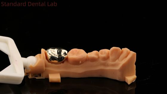 Nobel Tinggi Emas Kuning Mahkota Gigi Profesional Ni Be Gratis ISO Dan FDA Disetujui China Dental Lab