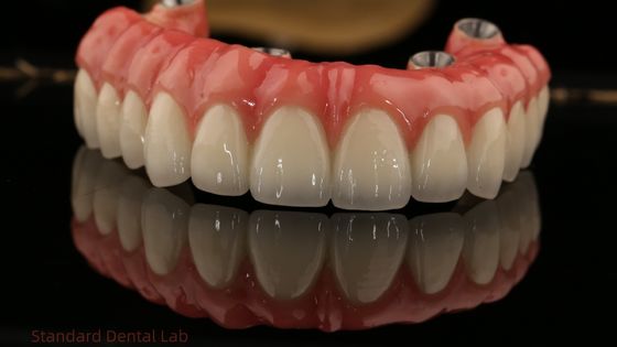 Full Arch Zirconia Implant Bridge Zirconia Crown Vita Shade Disesuaikan Semua Pada Empat / Enam Implan Gigi