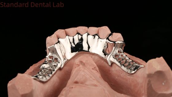 Cobalt Chrome Cast Metal Frame Parsial Gigi Gigi Dengan Pron Bawah Desain SDL Dental Lab