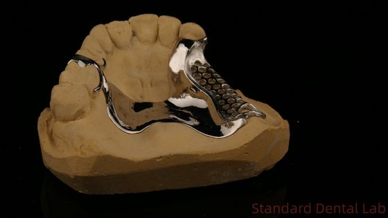 Kekuatan tinggi 3D cetak Cast Frame COCR Parsial gigi palsu Chrome Kobalt Cast Metal Frame