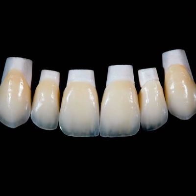 Penutup Porselen Emax Translucence Tinggi Mahkota dengan Bahan Lebih Baik oleh Ivoclar Vivadent