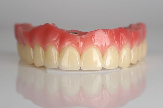 Full Arch Zirconia Implant Bridge All-on-Four / All-on-Six Implant Gigi cepat pulih