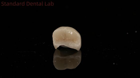 Translucence Dental Zirconia Crown Inlay Onlay Crown Untuk Memulihkan Bentuk Ruang Alam