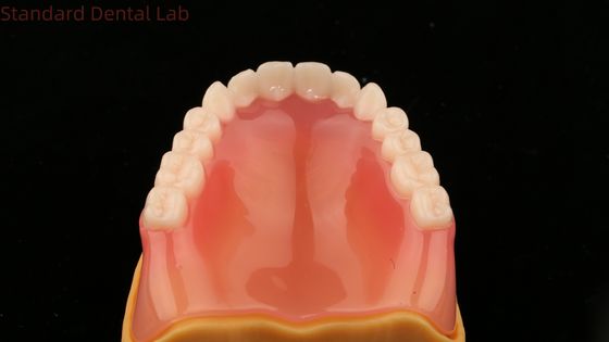 Gigi lengkap Ivoclar Gigi lengkap akrilik SDL Lab Gigi