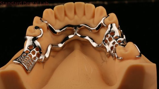 Kerangka Metal Cast Bagian Atas Gigi Parsial Kuat Ringan Dan awet