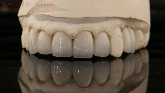 China Dental Lab Zirconia Full Contour Crown High Aesthetic Natural Dental Bridge Jaminan 5 Tahun