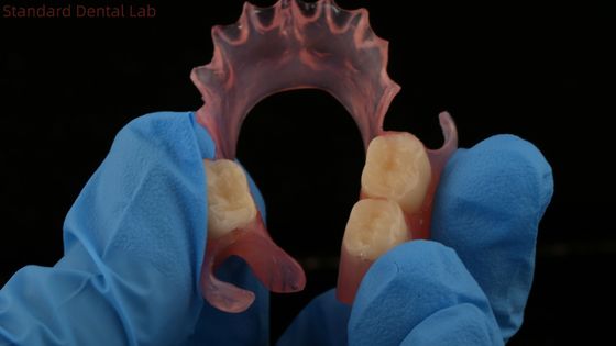 Dental TCS Valplast Fleksibel Parsial Gigi Nesbit Valplast Finish Cina Dental Lab Valplast Clamp