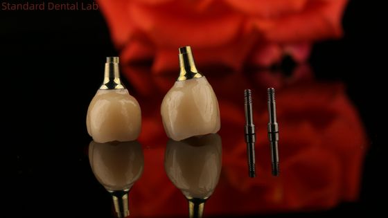Porselen Zirconia Cement Dipegang Screw Implant Bentuk Kepala Heksagonal untuk Custom Fit Estetika