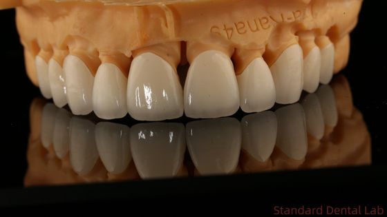 Full Contour Dental Lab Mahkota Translucence Tinggi Solid Zirconia Mahkota China laboratorium gigi
