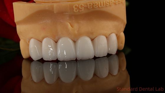 Full Contour Zirconia mahkota tembus pandang 3D PRO Tidak ada Overlay Porselen