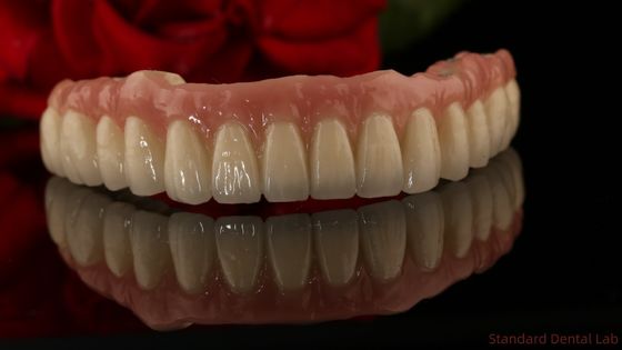 Implan Gigi Titanium Zirconia Semua Pada 4 Gigi Lengkungan Penuh Penggantian 3-6 Bulan Waktu penyembuhan