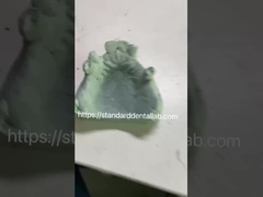 Fast and Cast Frame Co-Cr Metal Partial Denture Framework untuk Profesional Gigi