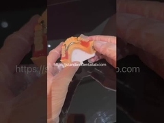 Estetika tinggi akrilik gigi palsu parsial dengan gesper yang jernih dan gigi akrilik China Dental Lab