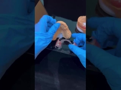 Kerangka kerja yang jelas Akrilik Metal Kerangka kerja gigi parsial Estetika tinggi China laboratorium gigi