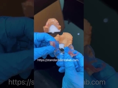 FDA Cobalt Chrome Tinggi Estetika Jelas Kerangka Parsial