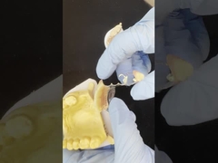 Kerangka Cast Cobalt Chrome yang dapat disesuaikan dengan stiker yang sangat baik