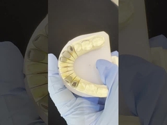 Metal Cast Post Core Crown Cocr Akurat Retentive Full Zirconia Bruxier