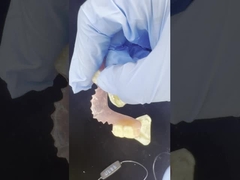 Gigi Valplast Fleksibel untuk kenyamanan alami dan kualitas estetika