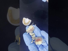 Kerangka Cast Cobalt Chrome yang dapat disesuaikan dengan stiker yang sangat baik