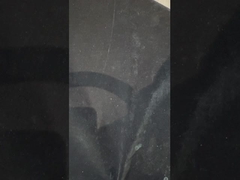 Titanium Implant Denture Mendukung Praktis Ivoclar Denture Over Implants