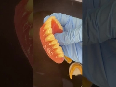 Full Upper dan Lower Stayplate Akrilik Bagian Gigi Gigi Ivoclar Permen karet